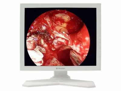 Monitor Reshin compacto para carro de endoscopia