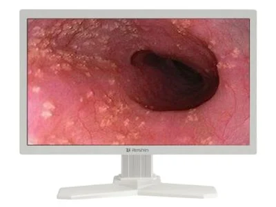 Monitor Reshin de pantalla ancha mostrando imagen endoscópica